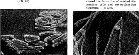 Figure 1 from Spheroplast-like structures in Escherichia coli demonstrated by scanning electron ...