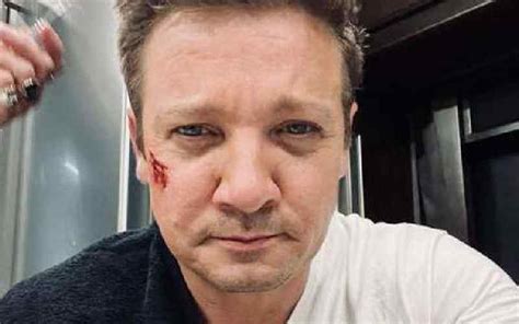 Jeremy Renner Avoids Surgery for Blunt Chest Trauma Injury