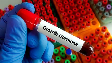 Pediatric Growth Hormone Deficiency Market Opportunities to 2028