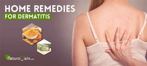 10 Best Home Remedies for Dermatitis to Prevent Eczema Scars [Fast]