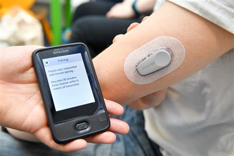 Surging Diabetes Market Lifts Dexcom Into Top Spot in S&P 500 - Bloomberg