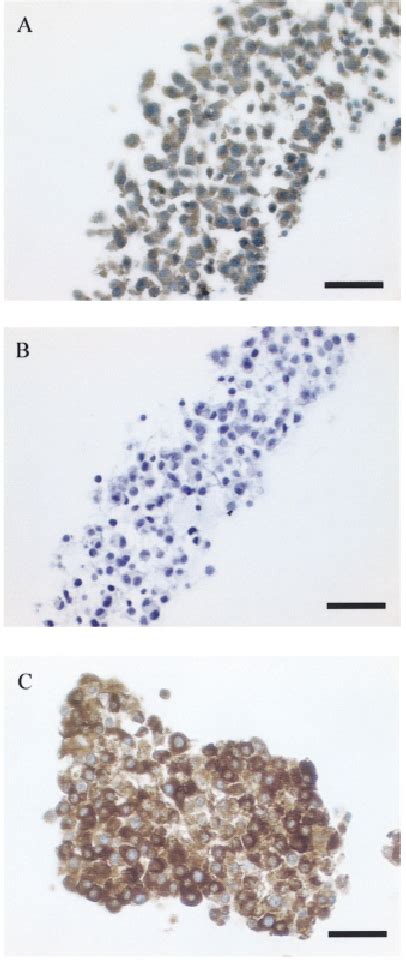 Immunostained sections of granulosa cell preparations. ( A ) Strong... | Download Scientific Diagram