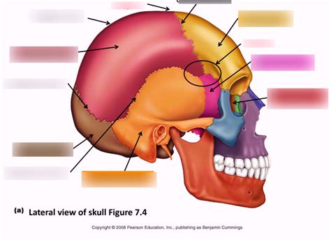 Surface Landmarks of the Skull - Lateral View Diagram | Quizlet