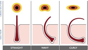 Hair Follicle Science and finding the best hair transplant doctor ...