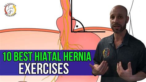 10 Best HIATAL HERNIA Exercises - YouTube