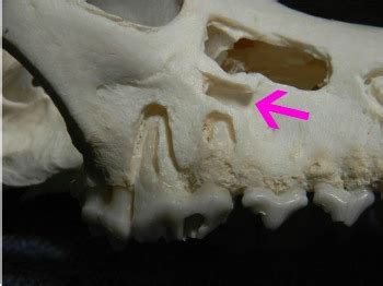 Maxillary Canine Root Canal Anatomy