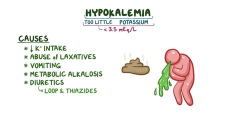 Conn Syndrome: What Is It, Causes, Symptoms, Diagnosis, Treatment, and More | Osmosis