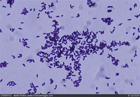Stock Image Photomicrograph Of Corynebacterium Diphtheriae The Cause | Free Download Nude Photo ...