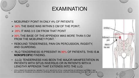 Acute appendicitis easy to diagnose