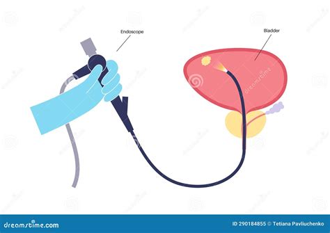 Cystoscopy Examination Concept Stock Vector - Illustration of ...