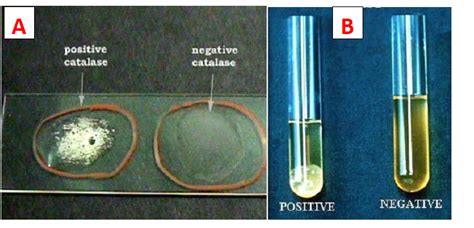 COAGULASE TEST - #1 Microbiology Resource Hub