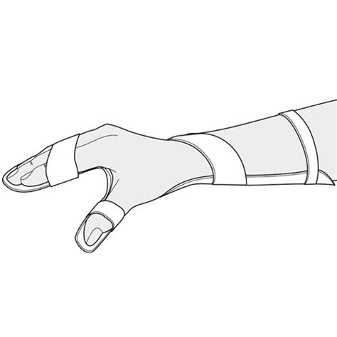 Guide Static Hand resting splint - Orfit Industries