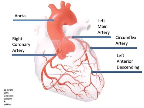 Coronary Angiography - HeartWest