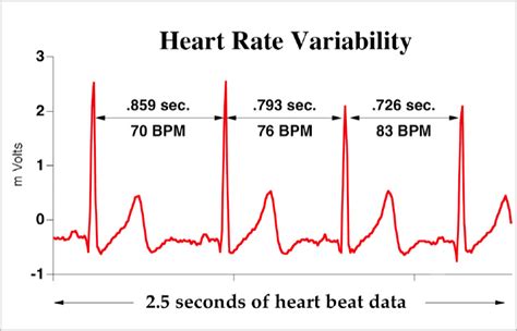 Heart Rate Variability and Sport Performance - ArmBeep