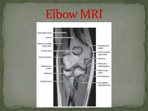 Elbow MRI