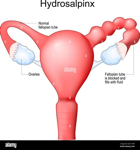 Epitelio trompa de falopio Imágenes vectoriales de stock - Alamy