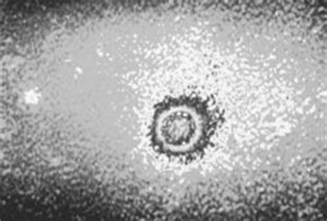 Rhinovirus - microbewiki