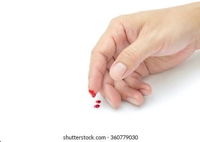 Injured Finger Bleeding Open Cut Stock Photo 360779039 | Shutterstock