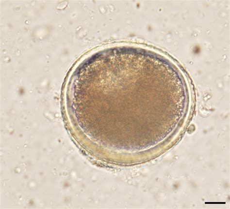 Toxocara cati Infection in Cats | Today's Veterinary Practice