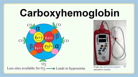 carboxyhemoglobin - YouTube