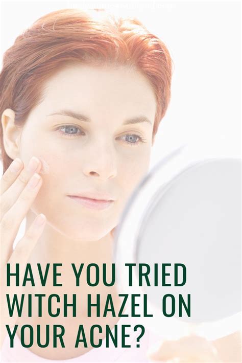 Witch hazel and acne - how to use witch hazel for acne healing ...