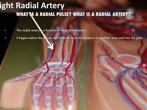 Radial Pulse by Emily Colucci