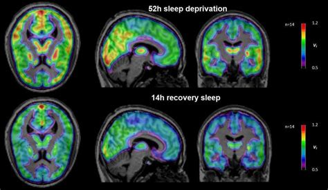 How the brain reacts to sleep deprivation | Sleep deprivation, Restorative sleep, Sleep