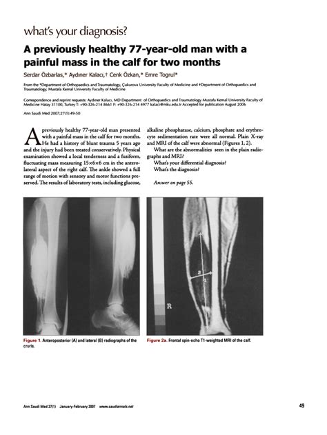 (PDF) A previously healthy 77-year-old man with a painful mass in the calf for two months ...