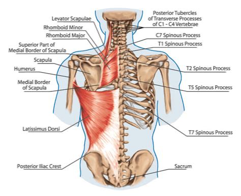 How to Alleviate a Stiff Neck: Effective Strategies