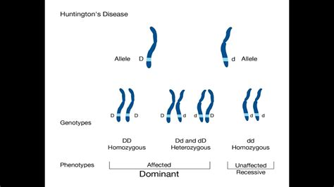 Huntington's disease (HD) Part 2; Inheritance Pattern - YouTube