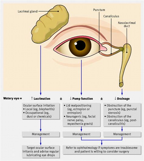 The Watery Eye | The BMJ