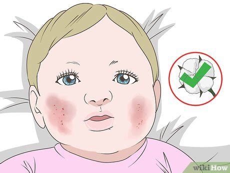 3 Ways to Get Rid of Baby Acne - wikiHow