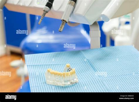 Denture fitting replacement isolated in dentist clinic Stock Photo - Alamy