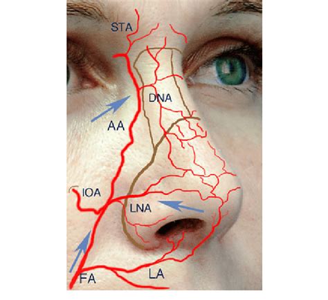 Main arterial supply to the nose and danger zones regarding fat... | Download Scientific Diagram