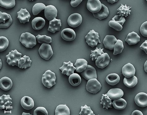 Scanning electron microscope (SEM) image of a RBC population having... | Download Scientific Diagram