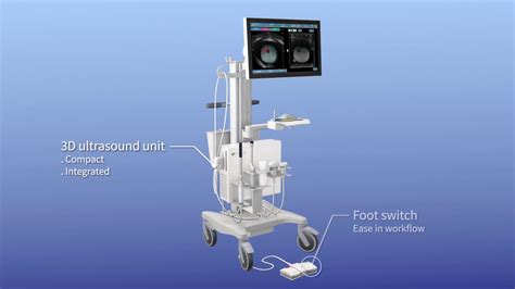 Prostate Mri Fusion Biopsy Procedure