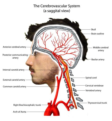 Pathophysiology | Carotid artery, Arteries anatomy, Arteries