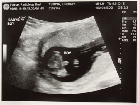 Adventures in Baby Making: 16 Weeks Ultrasound Pics