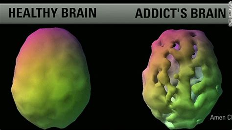 Brain scans could help better predict your behavior - CNN