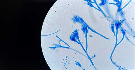 Penicillium Under Microscope 400x