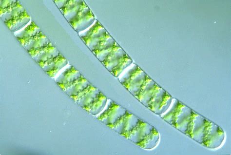 Spirogyra Cell