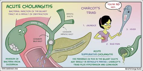 Cholangitis – Core EM