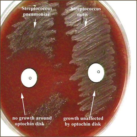 Streptococcus-Optochin Sensitivity Testing | Medical Laboratories