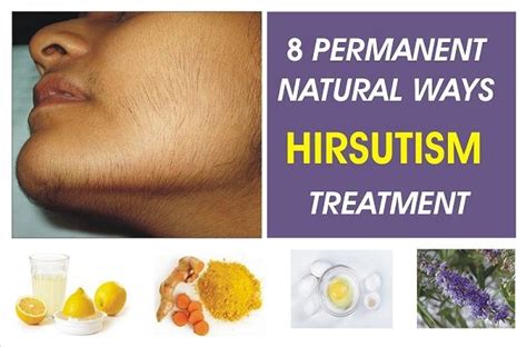 Hirsutism Chart