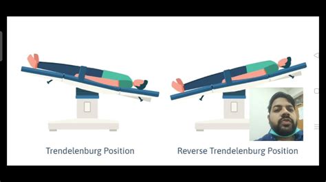 TRENDELENBURG AND REVERSE TRENDELENBURG POSITION || MNEMONIC - YouTube