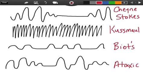 Respiratory Breathing Patterns