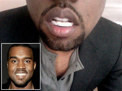 What a, uh, shiny smile! Kanye West shows off diamond and gold teeth - NY Daily News