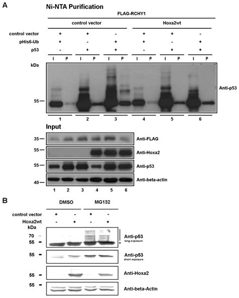 (A) Ubiquitination assays for p53. HEK293T cells were co-transfected... | Download Scientific ...