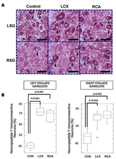 Neuropeptide Y immunoreactivity increases following MI A.... | Download ...