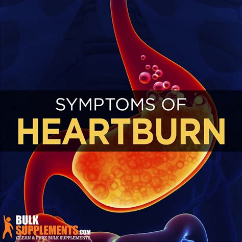 Heartburn: Symptoms, Causes & Treatment | by James Denlinger | Medium